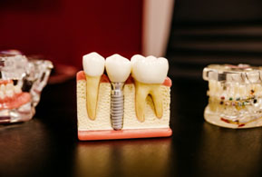 Case Study | A Chain of Dental Clinics in GC, Australia